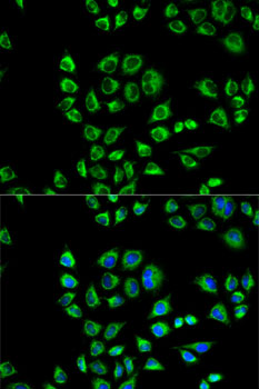 CD1D Rabbit polyclonal antibody