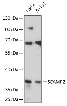 SCAMP2 Rabbit polyclonal antibody
