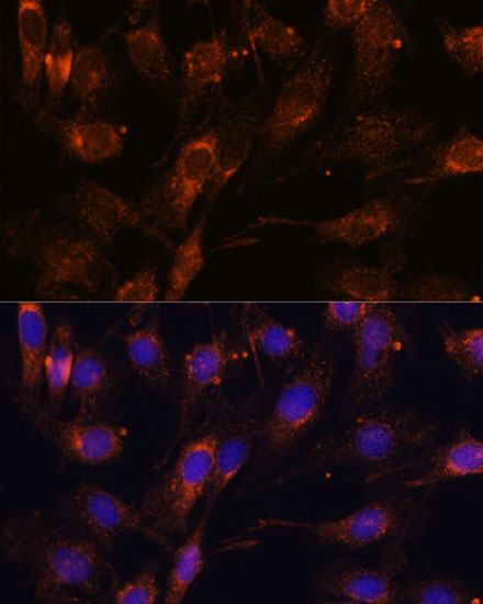SCAMP2 Rabbit polyclonal antibody