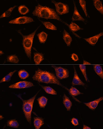 SCAMP2 Rabbit polyclonal antibody