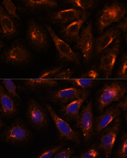 SCAMP2 Rabbit polyclonal antibody