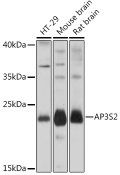 AP3S2 Rabbit polyclonal antibody