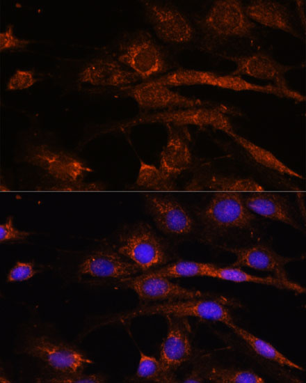 AP3S2 Rabbit polyclonal antibody