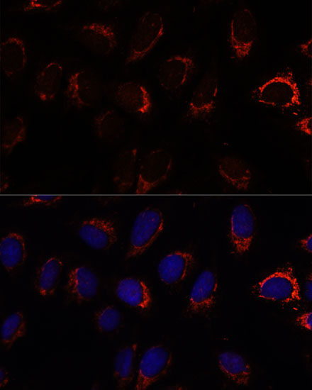 AP3S2 Rabbit polyclonal antibody