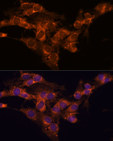TMED2 Rabbit polyclonal antibody