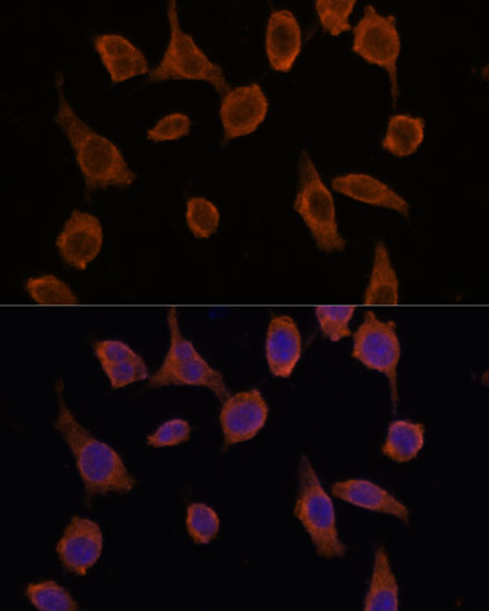 TMED2 Rabbit polyclonal antibody