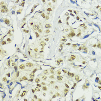 BAZ2A Rabbit polyclonal antibody