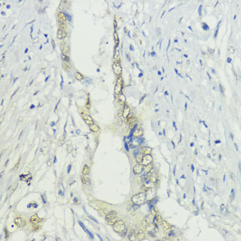 BAZ2A Rabbit polyclonal antibody
