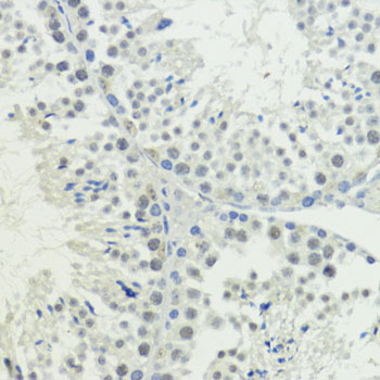 BAZ2A Rabbit polyclonal antibody