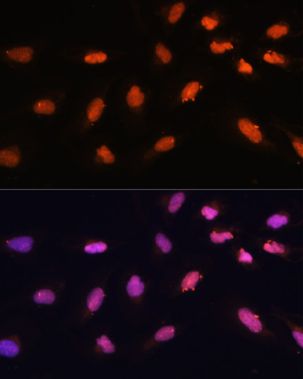 BAZ2A Rabbit polyclonal antibody