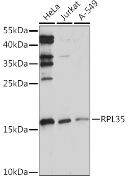RPL35 Rabbit polyclonal antibody