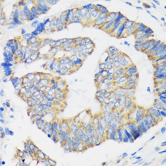 RPL35 Rabbit polyclonal antibody