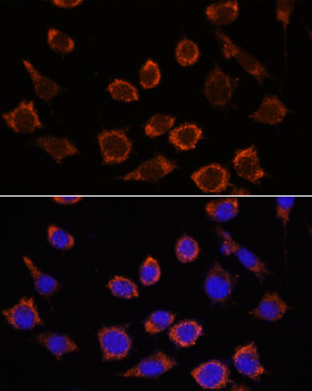 RPL35 Rabbit polyclonal antibody