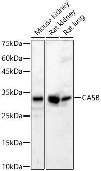 CA5B Rabbit polyclonal antibody