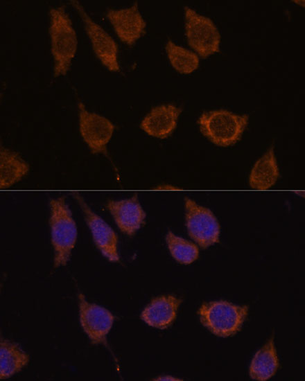 CA5B Rabbit polyclonal antibody