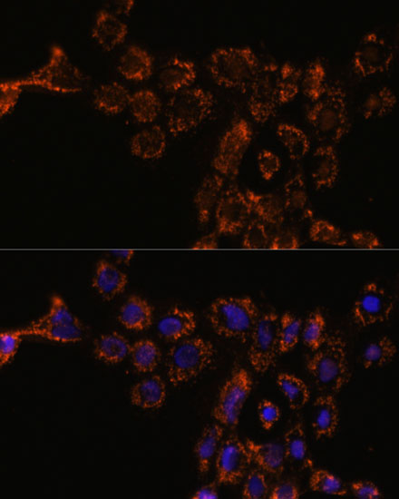HSPA4L Rabbit polyclonal antibody