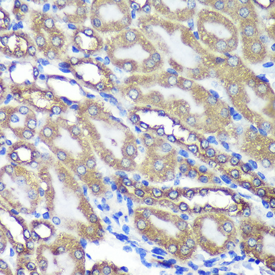 ANKLE2 Rabbit polyclonal antibody