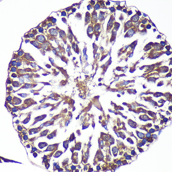 ANKLE2 Rabbit polyclonal antibody