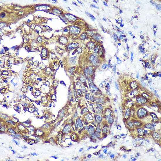 ANKLE2 Rabbit polyclonal antibody