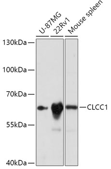CLCC1 Rabbit polyclonal antibody