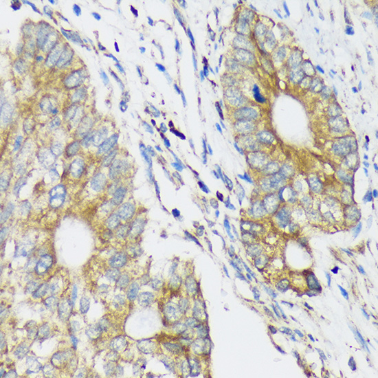 CLCC1 Rabbit polyclonal antibody