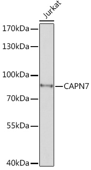 CAPN7 Rabbit polyclonal antibody