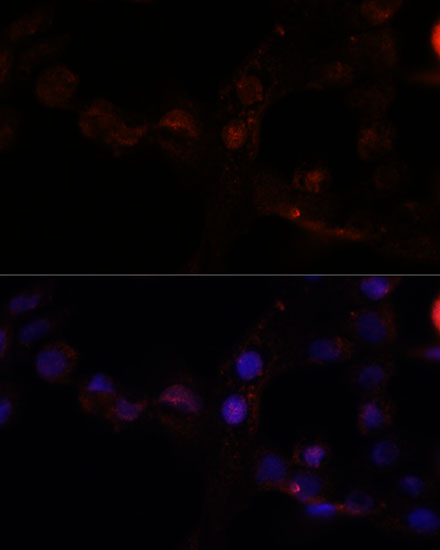 CAPN7 Rabbit polyclonal antibody