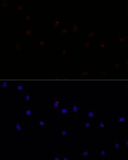 CAPN7 Rabbit polyclonal antibody