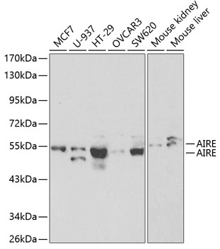 AIRE Rabbit polyclonal antibody