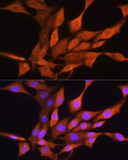AIRE Rabbit polyclonal antibody