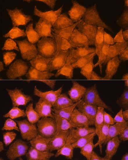 AIRE Rabbit polyclonal antibody