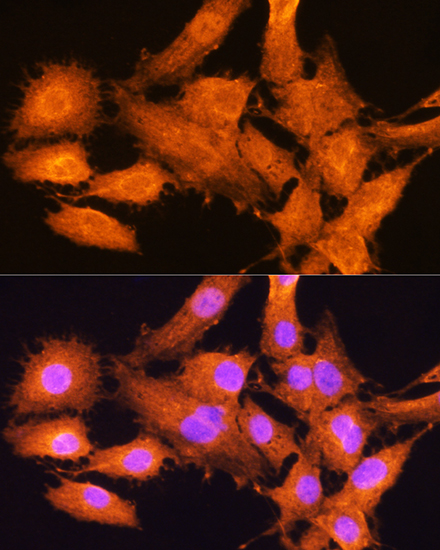 AIRE Rabbit polyclonal antibody