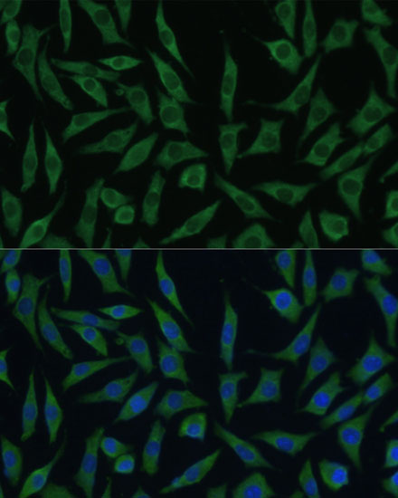 SUMF2 Rabbit polyclonal antibody
