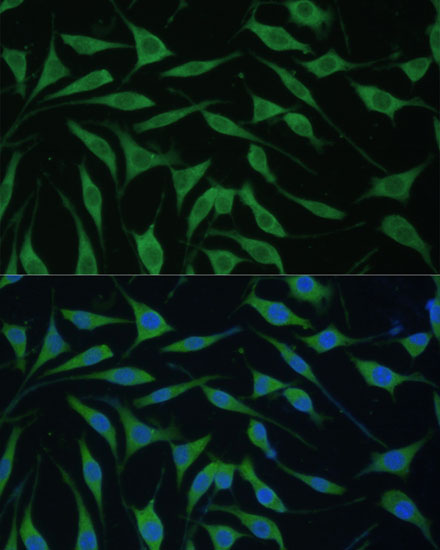 FAM127B Rabbit polyclonal antibody