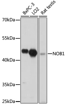 NOB1 Rabbit polyclonal antibody