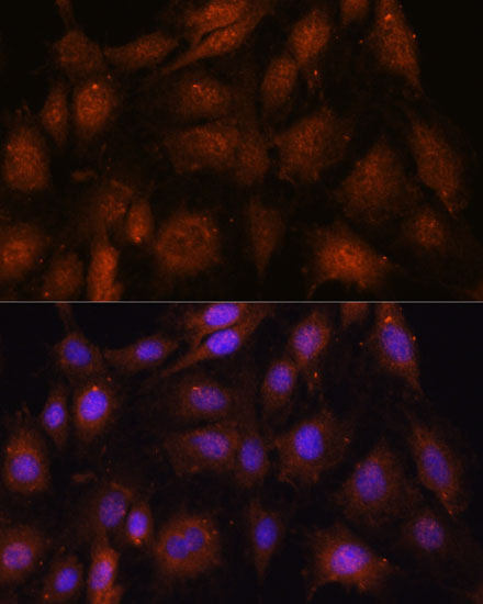 NOB1 Rabbit polyclonal antibody