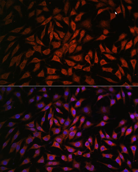 NOB1 Rabbit polyclonal antibody