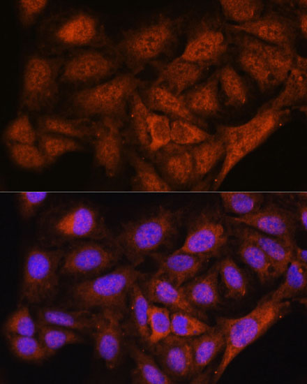 NOB1 Rabbit polyclonal antibody