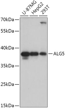 ALG5 Rabbit polyclonal antibody