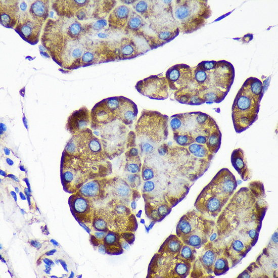ALG5 Rabbit polyclonal antibody