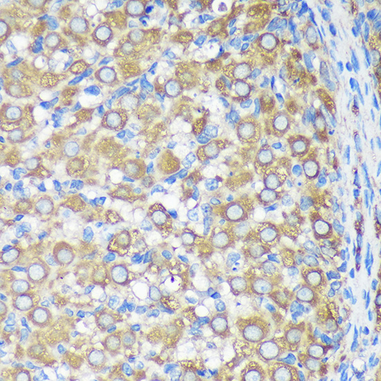 ALG5 Rabbit polyclonal antibody