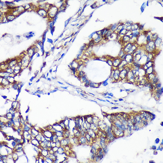 ALG5 Rabbit polyclonal antibody