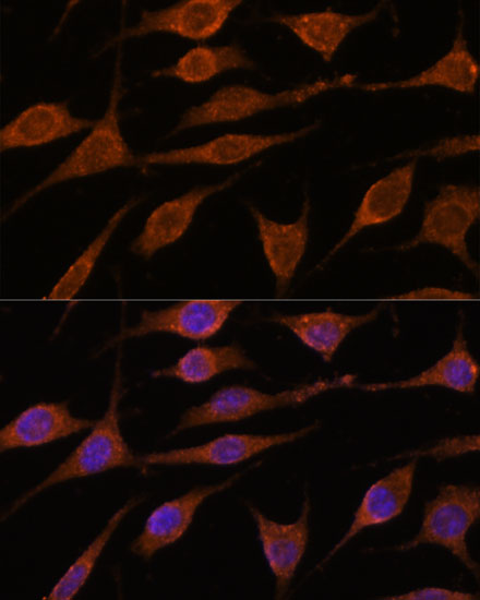ALG5 Rabbit polyclonal antibody