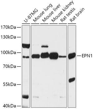 EPN1 Rabbit polyclonal antibody
