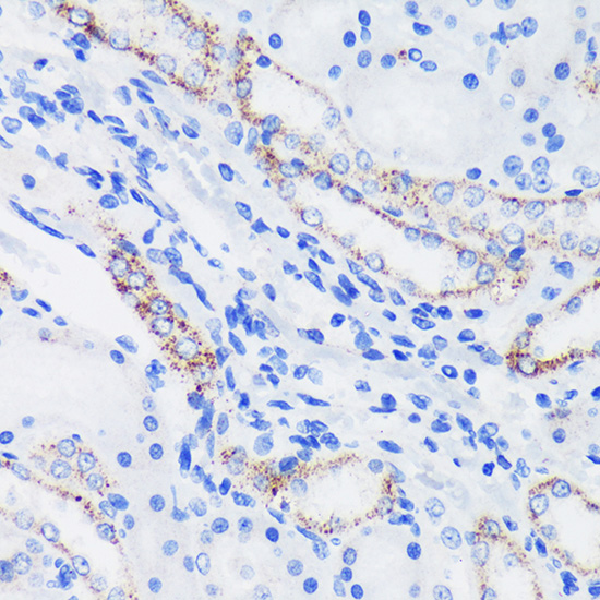EPN1 Rabbit polyclonal antibody