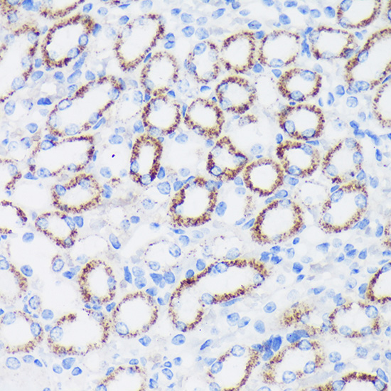 EPN1 Rabbit polyclonal antibody