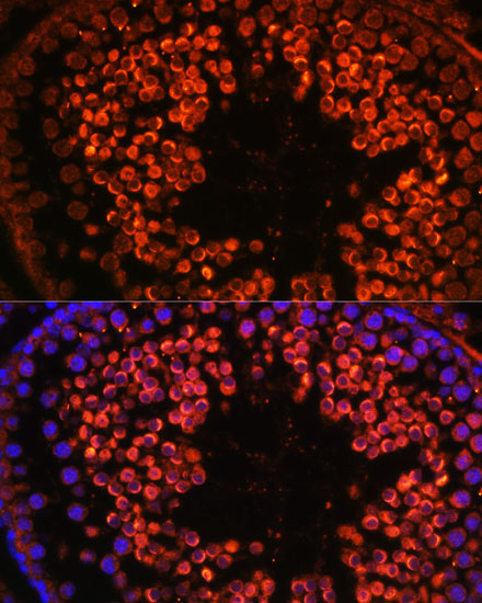 UBQLN3 Rabbit polyclonal antibody