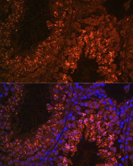 UBQLN3 Rabbit polyclonal antibody