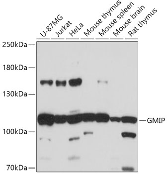 GMIP Rabbit polyclonal antibody
