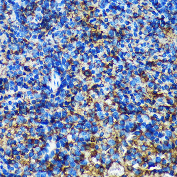 GMIP Rabbit polyclonal antibody